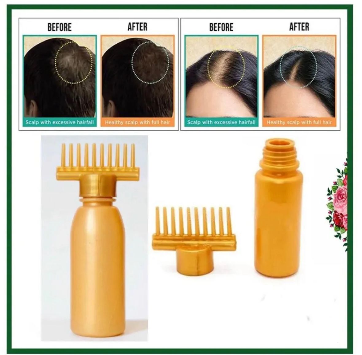 Hair oil bottle with comb